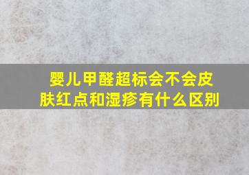 婴儿甲醛超标会不会皮肤红点和湿疹有什么区别