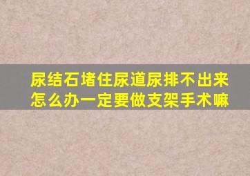 尿结石堵住尿道尿排不出来怎么办一定要做支架手术嘛