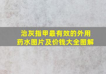 治灰指甲最有效的外用药水图片及价钱大全图解