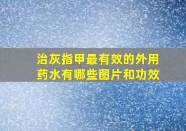 治灰指甲最有效的外用药水有哪些图片和功效