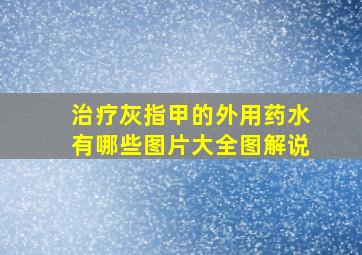 治疗灰指甲的外用药水有哪些图片大全图解说