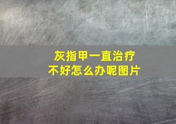 灰指甲一直治疗不好怎么办呢图片