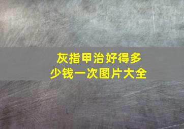 灰指甲治好得多少钱一次图片大全