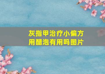 灰指甲治疗小偏方用醋泡有用吗图片