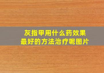 灰指甲用什么药效果最好的方法治疗呢图片