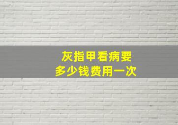 灰指甲看病要多少钱费用一次