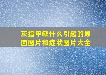 灰指甲缺什么引起的原因图片和症状图片大全