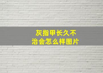 灰指甲长久不治会怎么样图片