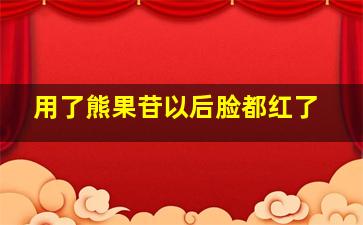 用了熊果苷以后脸都红了