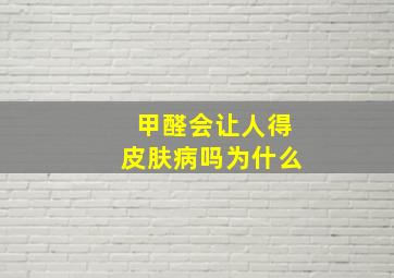 甲醛会让人得皮肤病吗为什么