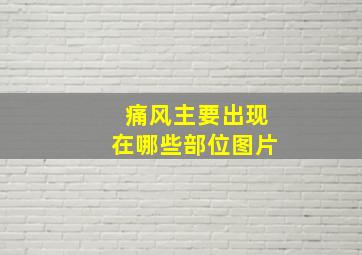 痛风主要出现在哪些部位图片