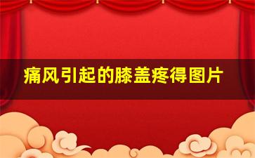 痛风引起的膝盖疼得图片