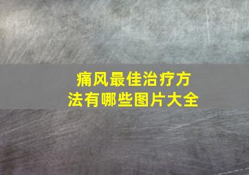 痛风最佳治疗方法有哪些图片大全