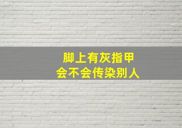 脚上有灰指甲会不会传染别人