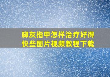 脚灰指甲怎样治疗好得快些图片视频教程下载