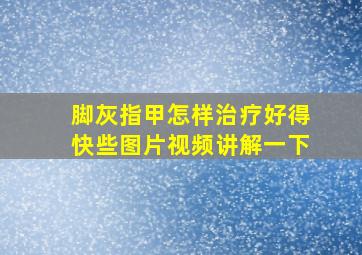 脚灰指甲怎样治疗好得快些图片视频讲解一下