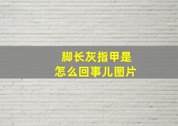 脚长灰指甲是怎么回事儿图片