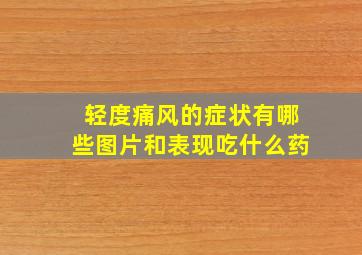 轻度痛风的症状有哪些图片和表现吃什么药