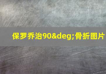 保罗乔治90°骨折图片