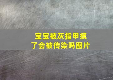 宝宝被灰指甲摸了会被传染吗图片