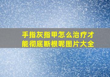 手指灰指甲怎么治疗才能彻底断根呢图片大全