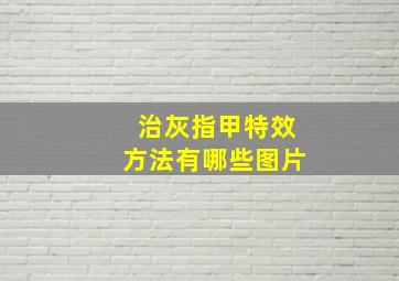 治灰指甲特效方法有哪些图片