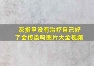 灰指甲没有治疗自己好了会传染吗图片大全视频