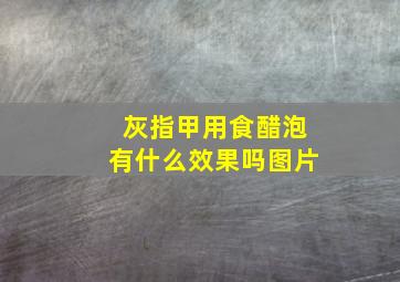 灰指甲用食醋泡有什么效果吗图片