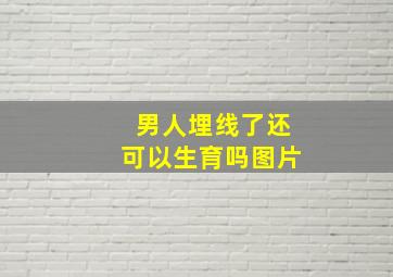 男人埋线了还可以生育吗图片