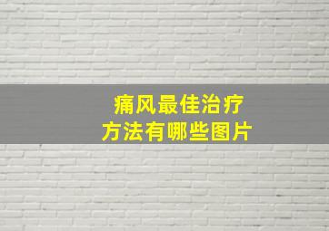 痛风最佳治疗方法有哪些图片