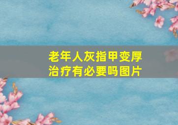 老年人灰指甲变厚治疗有必要吗图片