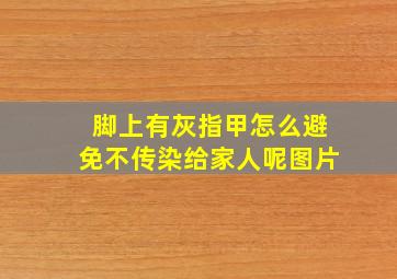 脚上有灰指甲怎么避免不传染给家人呢图片