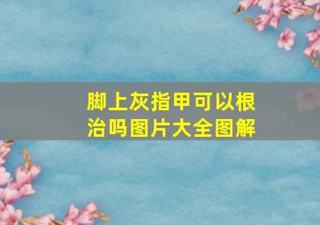 脚上灰指甲可以根治吗图片大全图解