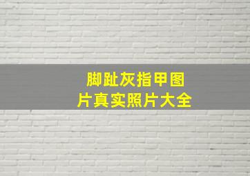 脚趾灰指甲图片真实照片大全